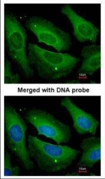 PP1 gamma Antibody in Immunocytochemistry (ICC/IF)