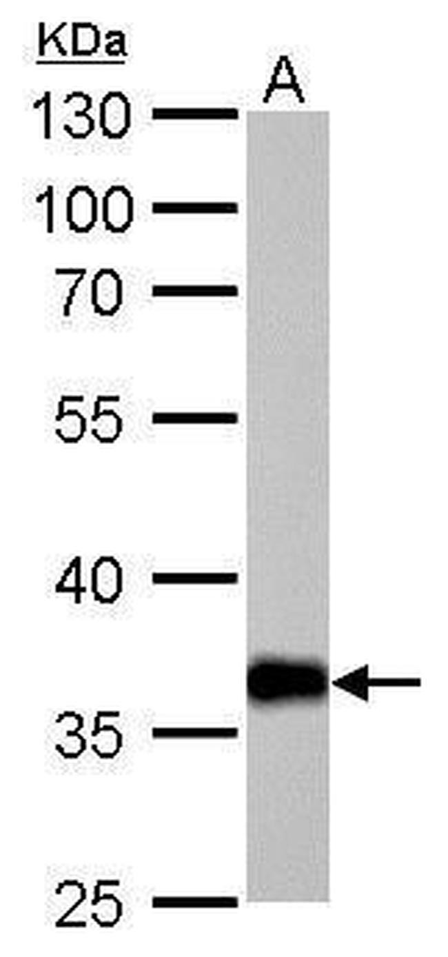 AKR1C1 Antibody in Western Blot (WB)