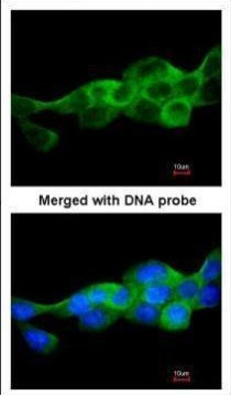 IKK beta Antibody in Immunocytochemistry (ICC/IF)