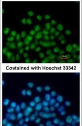 Nkx2.5 Antibody in Immunocytochemistry (ICC/IF)