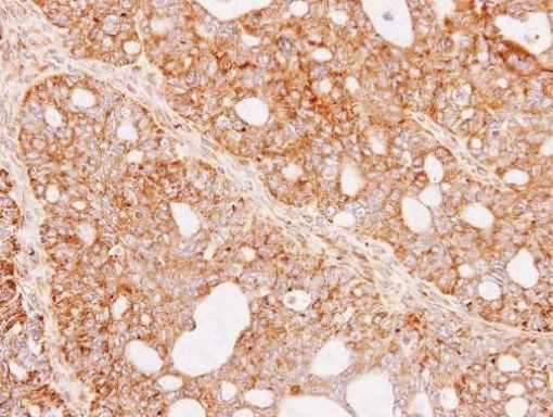 Renin Antibody in Immunohistochemistry (Paraffin) (IHC (P))