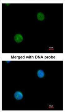 MYBPC2 Antibody in Immunocytochemistry (ICC/IF)