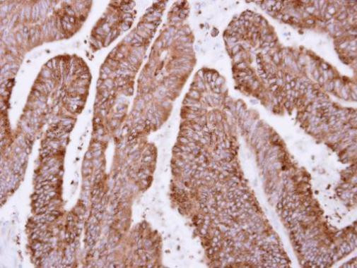 OSGEP Antibody in Immunohistochemistry (Paraffin) (IHC (P))