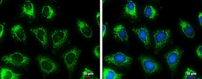 MDH2 Antibody in Immunocytochemistry (ICC/IF)