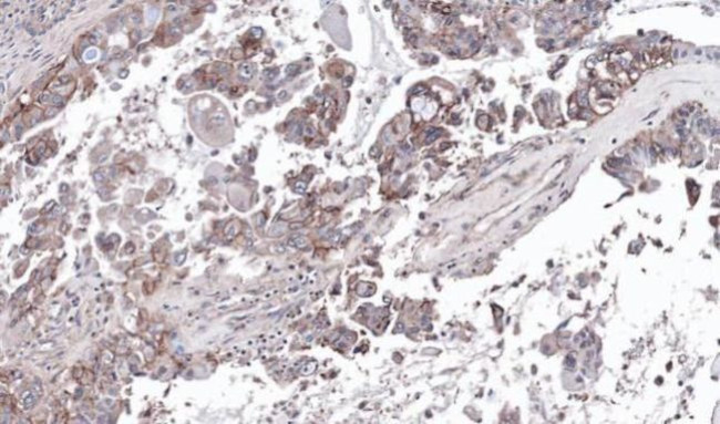 GNAS Antibody in Immunohistochemistry (Paraffin) (IHC (P))