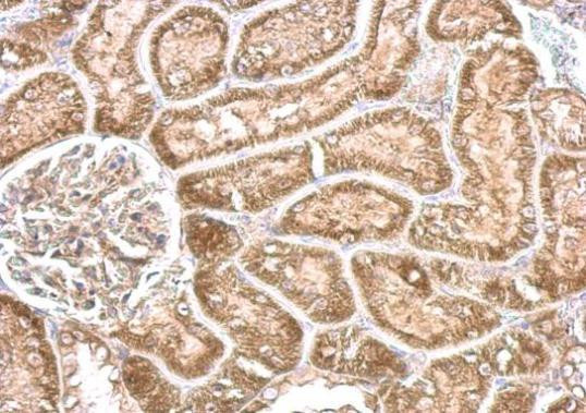 CYP24A1 Antibody in Immunohistochemistry (Paraffin) (IHC (P))