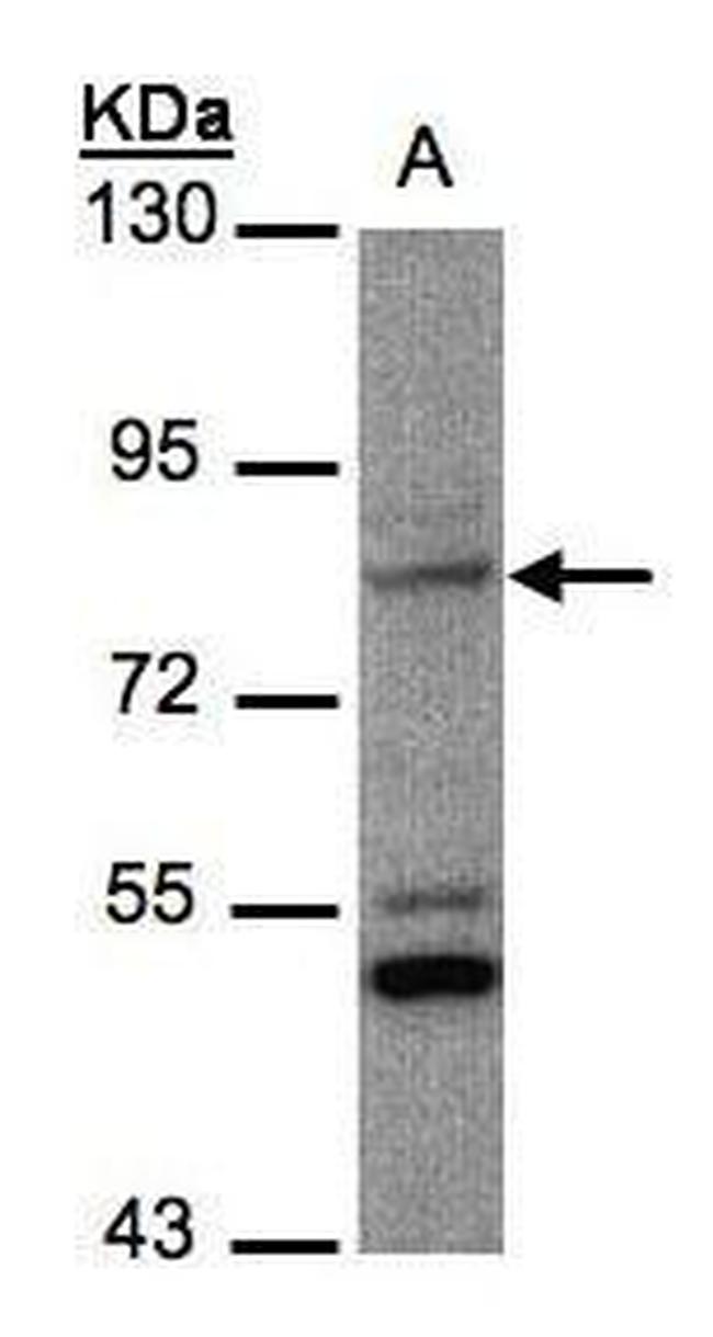 PHEX Antibody in Western Blot (WB)