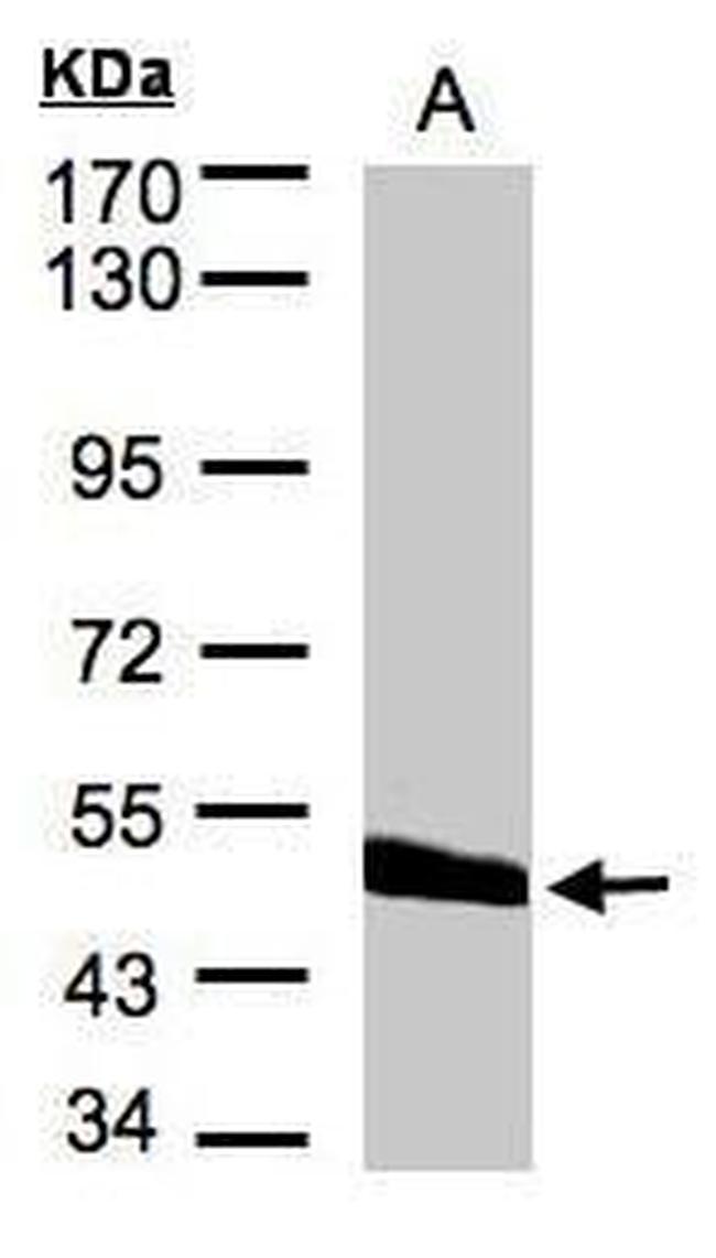 CPVL Antibody in Western Blot (WB)