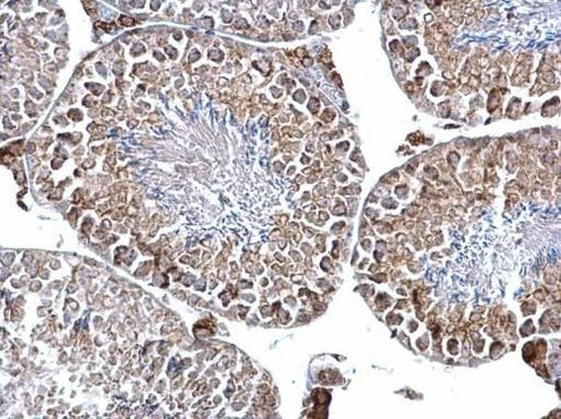 DGAT2 Antibody in Immunohistochemistry (Paraffin) (IHC (P))