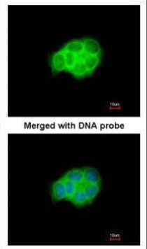 HSPA6 Antibody in Immunocytochemistry (ICC/IF)