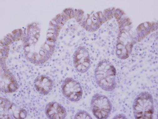 CCDC83 Antibody in Immunohistochemistry (Paraffin) (IHC (P))