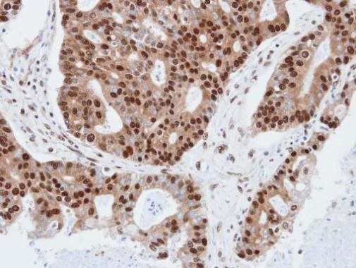 PDE4C Antibody in Immunohistochemistry (Paraffin) (IHC (P))