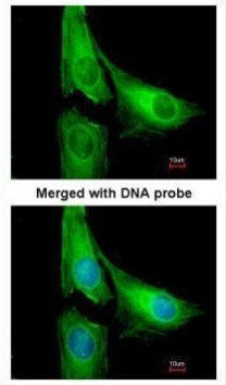 AGAP1 Antibody in Immunocytochemistry (ICC/IF)