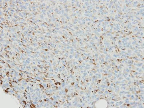 SNX18 Antibody in Immunohistochemistry (Paraffin) (IHC (P))