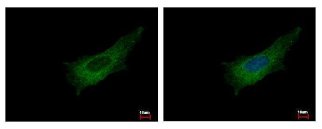 Pleckstrin Antibody in Immunocytochemistry (ICC/IF)