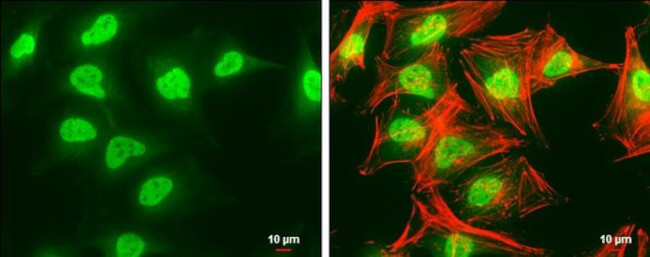 SET Antibody in Immunocytochemistry (ICC/IF)
