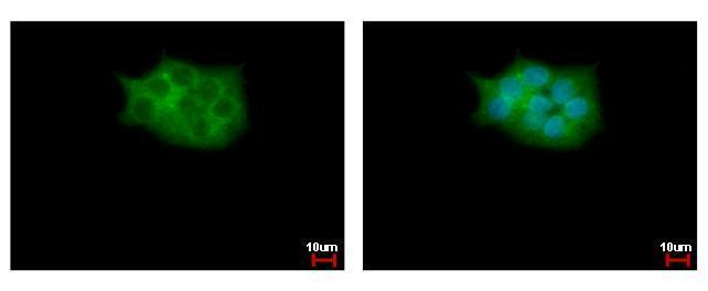 SKAP2 Antibody in Immunocytochemistry (ICC/IF)