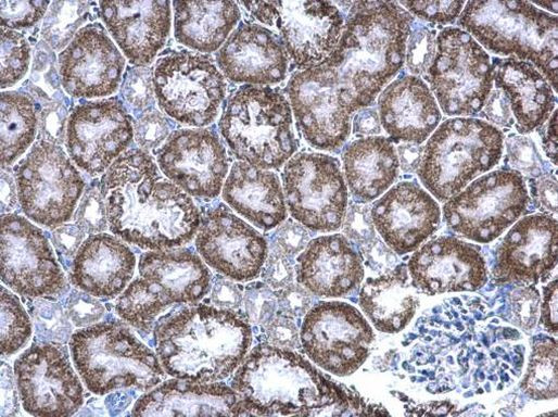 GIPC1 Antibody in Immunohistochemistry (Paraffin) (IHC (P))