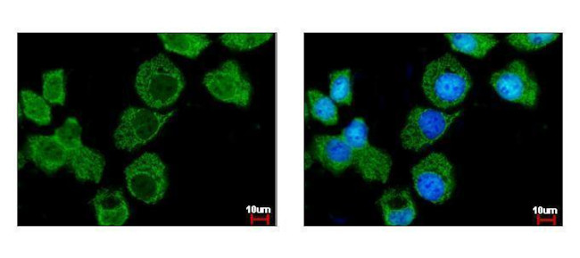 Importin 7 Antibody in Immunocytochemistry (ICC/IF)