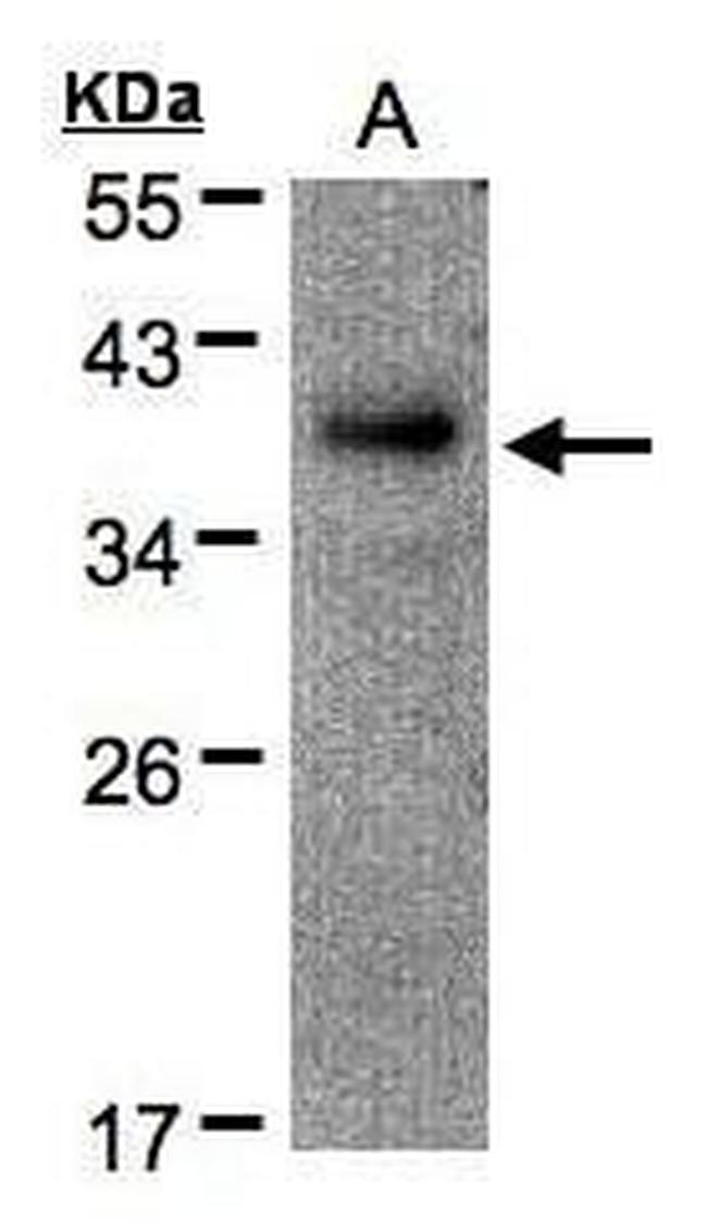 RAD51AP1 Antibody in Western Blot (WB)