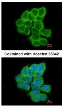 RGS17 Antibody in Immunocytochemistry (ICC/IF)