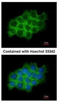 SEC61A1 Antibody in Immunocytochemistry (ICC/IF)