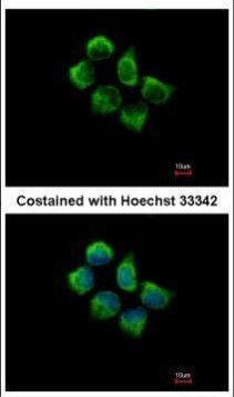 SNX12 Antibody in Immunocytochemistry (ICC/IF)