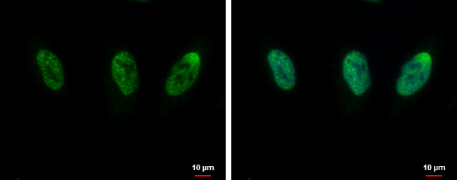 SARNP Antibody in Immunocytochemistry (ICC/IF)