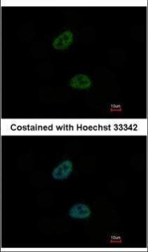 TWA1 Antibody in Immunocytochemistry (ICC/IF)