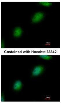 TPRKB Antibody in Immunocytochemistry (ICC/IF)