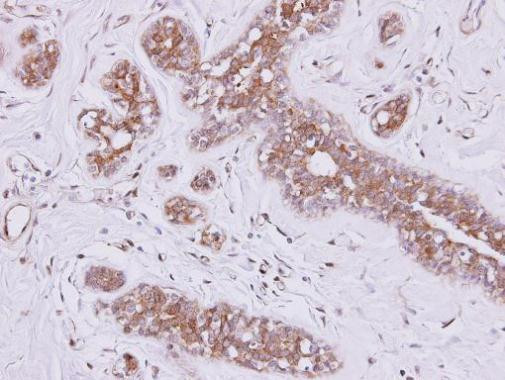 FSD2 Antibody in Immunohistochemistry (Paraffin) (IHC (P))