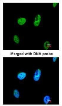 TATDN1 Antibody in Immunocytochemistry (ICC/IF)