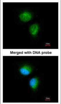 MMACHC Antibody in Immunocytochemistry (ICC/IF)