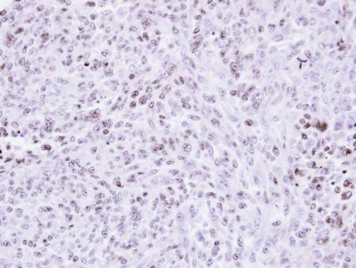 ZNF707 Antibody in Immunohistochemistry (Paraffin) (IHC (P))