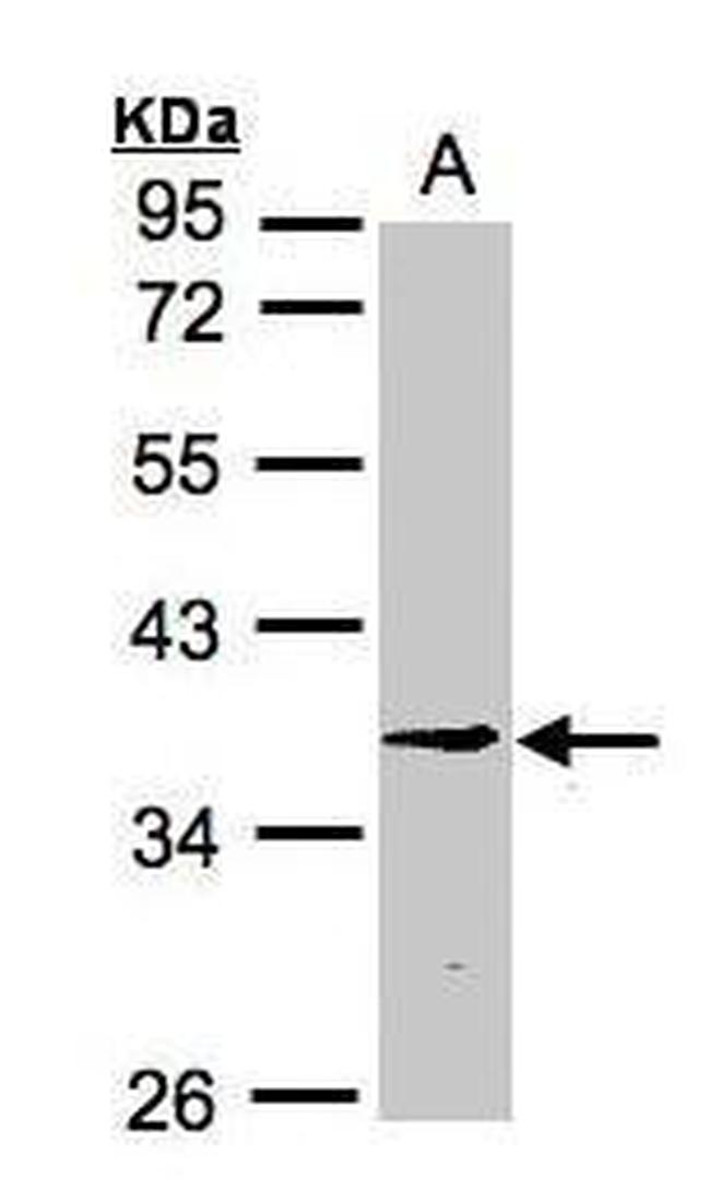 BXDC1 Antibody in Western Blot (WB)