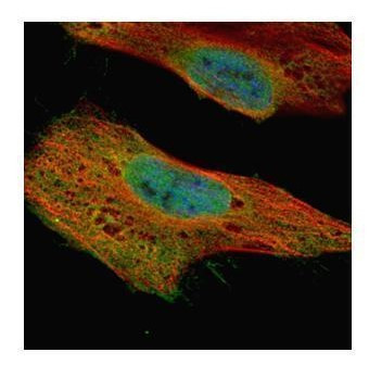 GLE1 Antibody in Immunocytochemistry (ICC/IF)