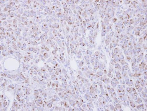 RGMB Antibody in Immunohistochemistry (Paraffin) (IHC (P))