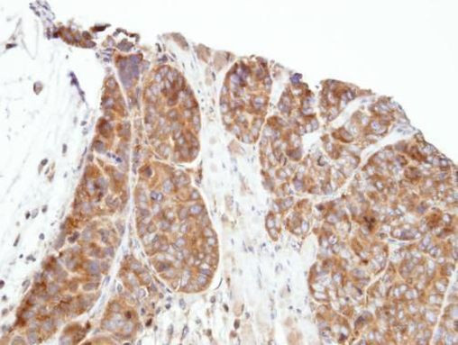 PRPSAP1 Antibody in Immunohistochemistry (Paraffin) (IHC (P))
