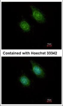 CAMK1D Antibody in Immunocytochemistry (ICC/IF)