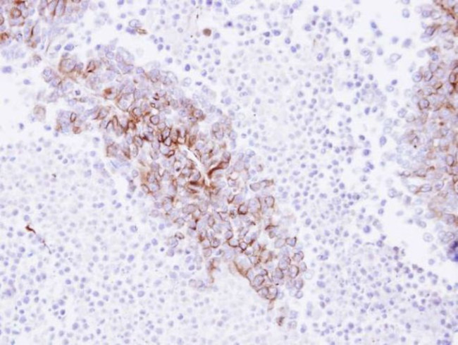 EphA8 Antibody in Immunohistochemistry (IHC)