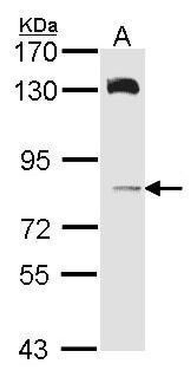 HPS6 Antibody in Western Blot (WB)