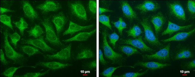 ORP6 Antibody in Immunocytochemistry (ICC/IF)