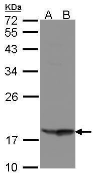 RARRES3 Antibody in Western Blot (WB)