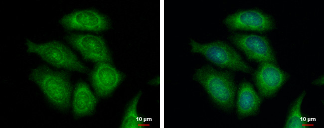 FASTKD1 Antibody in Immunocytochemistry (ICC/IF)