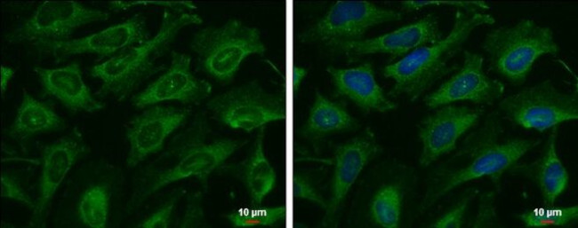 Adenylate Kinase 8 Antibody in Immunocytochemistry (ICC/IF)