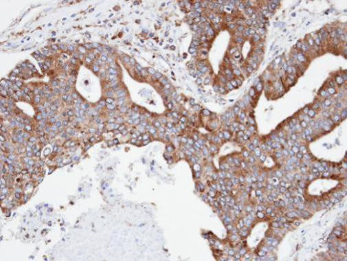 CPNE3 Antibody in Immunohistochemistry (Paraffin) (IHC (P))
