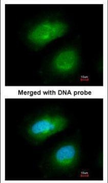 PRAK Antibody in Immunocytochemistry (ICC/IF)