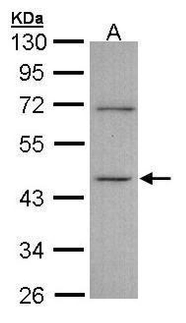 ITPK1 Antibody in Western Blot (WB)