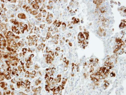 Importin 13 Antibody in Immunohistochemistry (Paraffin) (IHC (P))