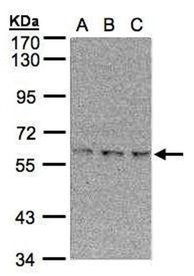 EPM2AIP1 Antibody in Western Blot (WB)